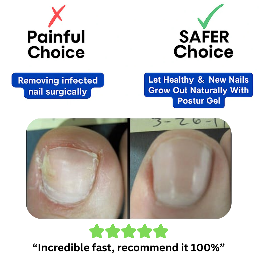 FungalFix™ Nail Renewal Patches